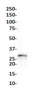 Western blot - Anti-Prostate Specific Antigen antibody [SP317] (AB224799)