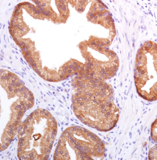 Immunohistochemistry (Formalin/PFA-fixed paraffin-embedded sections) - Anti-Prostate Specific Antigen antibody [SP317] - BSA and Azide free (AB240982)