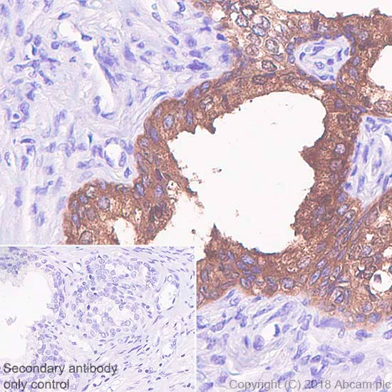 Immunohistochemistry (Formalin/PFA-fixed paraffin-embedded sections) - Anti-Prostate Specific Antigen antibody [SP317] - BSA and Azide free (AB240982)