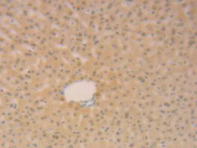 Immunohistochemistry (Formalin/PFA-fixed paraffin-embedded sections) - Anti-Prosurfactant Protein B antibody (AB231551)
