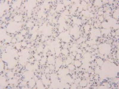 Immunohistochemistry (Formalin/PFA-fixed paraffin-embedded sections) - Anti-Prosurfactant Protein B antibody (AB231551)