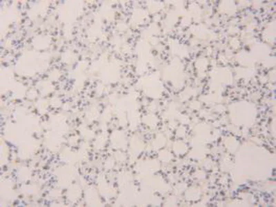 Immunohistochemistry (Formalin/PFA-fixed paraffin-embedded sections) - Anti-Prosurfactant Protein B antibody (AB231551)