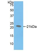 Western blot - Anti-Prosurfactant Protein B antibody (AB231551)