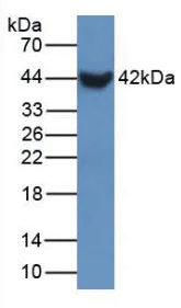 Western blot - Anti-Prosurfactant Protein B antibody (AB231551)