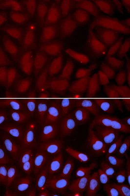 Immunocytochemistry/ Immunofluorescence - Anti-Prosurfactant Protein C antibody (AB196677)