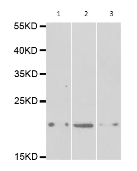 Western blot - Anti-Prosurfactant Protein C antibody (AB196677)