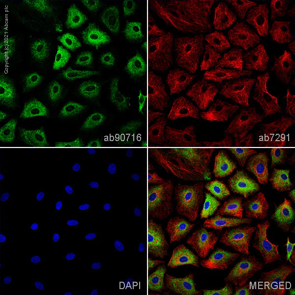Immunocytochemistry/ Immunofluorescence - Anti-Prosurfactant Protein C antibody (AB90716)