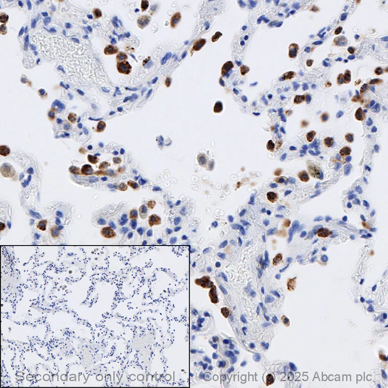 Immunohistochemistry (Formalin/PFA-fixed paraffin-embedded sections) - Anti-Prosurfactant Protein C antibody (AB90716)