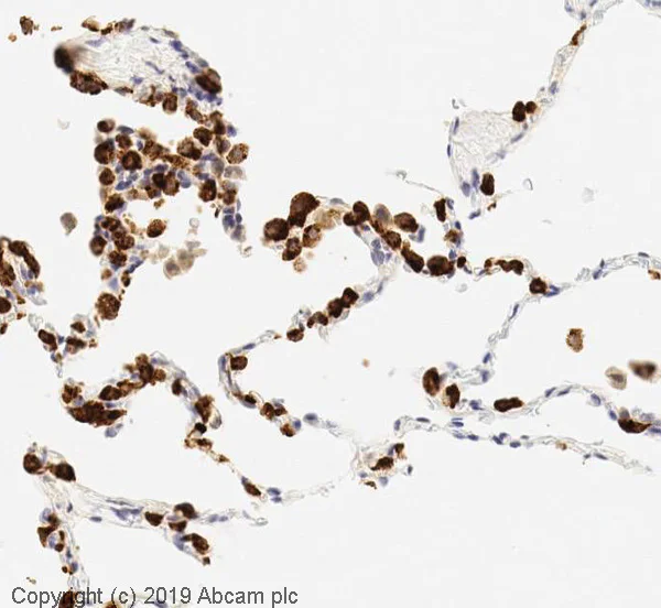 Immunohistochemistry (Formalin/PFA-fixed paraffin-embedded sections) - Anti-Prosurfactant Protein C antibody (AB90716)