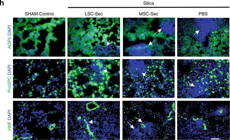 Immunohistochemistry - Anti-Prosurfactant Protein C antibody (AB90716)