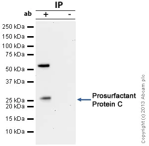 Immunoprecipitation - Anti-Prosurfactant Protein C antibody (AB90716)