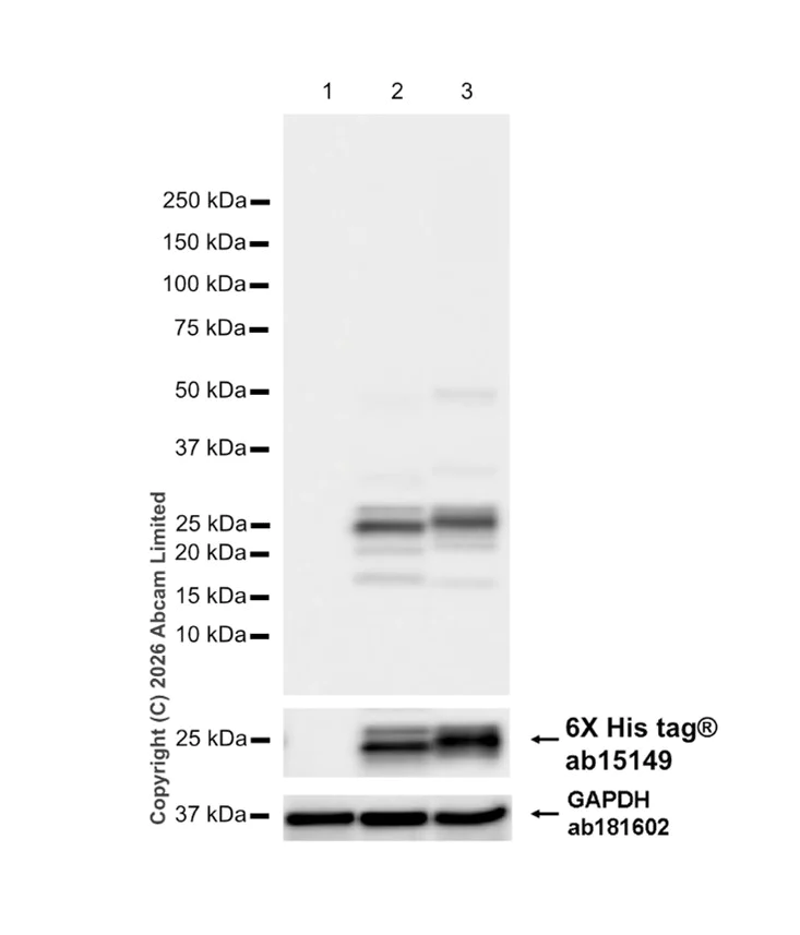 Western blot - Anti-Prosurfactant Protein C antibody (AB90716)