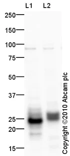 Western blot - Anti-Prosurfactant Protein C antibody (AB90716)