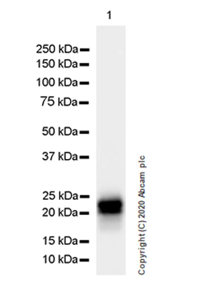 Western blot - Anti-Prosurfactant Protein C antibody [EPR19839-8] (AB270521)