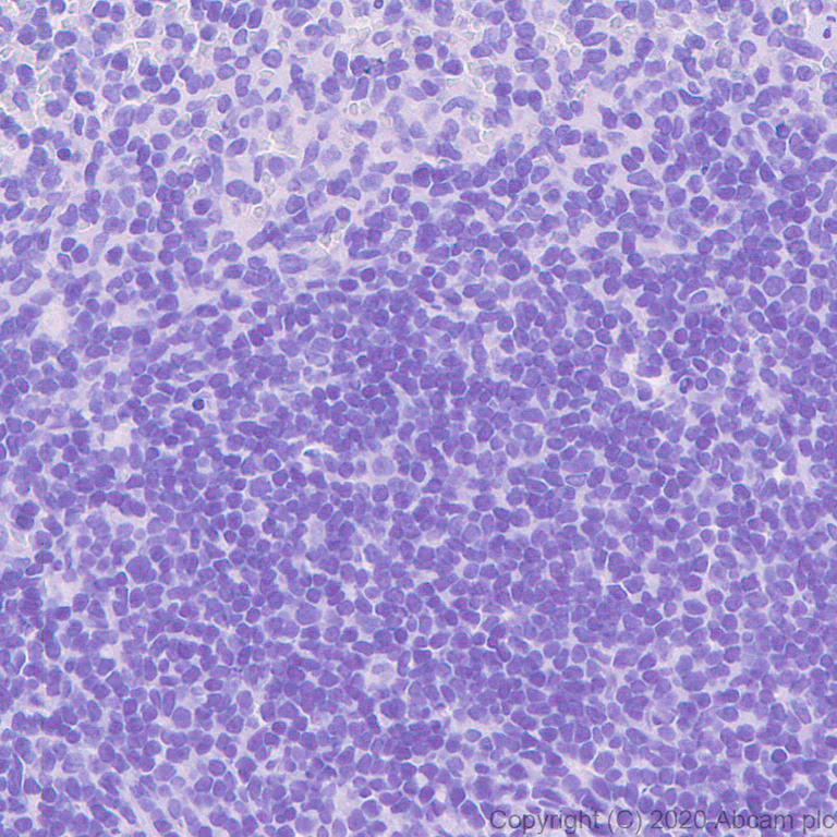 Immunohistochemistry (Formalin/PFA-fixed paraffin-embedded sections) - Anti-Prosurfactant Protein C antibody [EPR19839-8] - BSA and Azide free (AB270526)