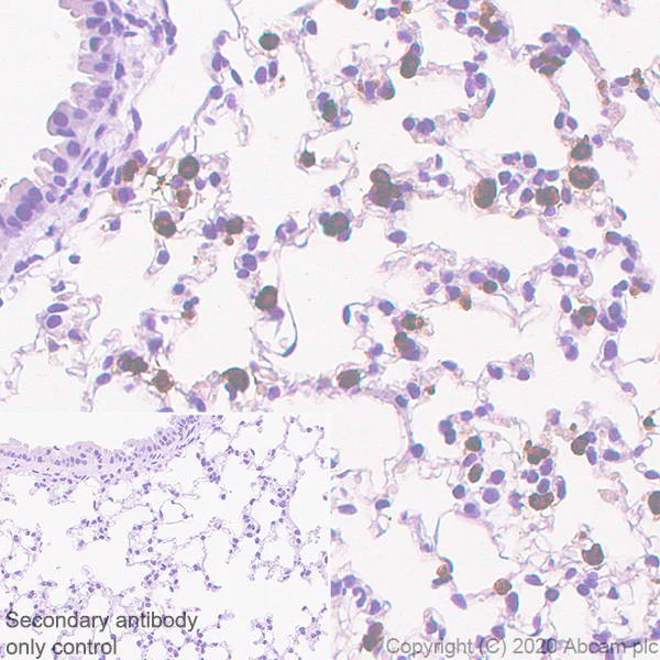 Immunohistochemistry (Formalin/PFA-fixed paraffin-embedded sections) - Anti-Prosurfactant Protein C antibody [EPR19839-8] - BSA and Azide free (AB270526)