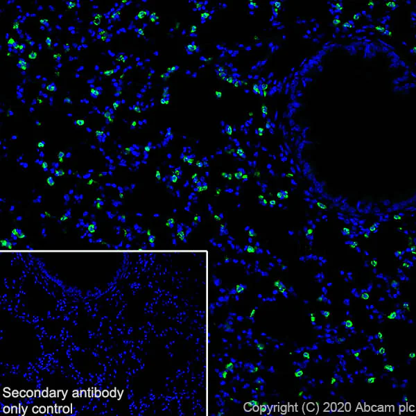 Immunohistochemistry (Frozen sections) - Anti-Prosurfactant Protein C antibody [EPR19839-8] - BSA and Azide free (AB270526)
