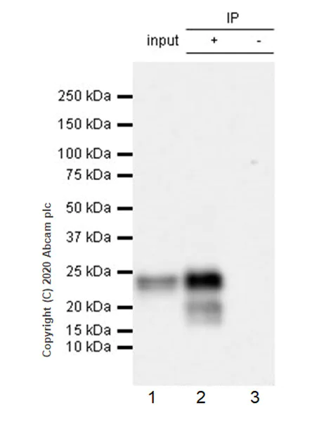 Immunoprecipitation - Anti-Prosurfactant Protein C antibody [EPR19839-8] - BSA and Azide free (AB270526)