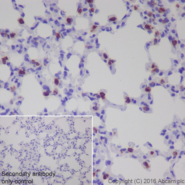 Immunohistochemistry (Formalin/PFA-fixed paraffin-embedded sections) - Anti-Prosurfactant Protein C antibody [EPR19839] (AB211326)