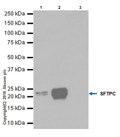 Immunoprecipitation - Anti-Prosurfactant Protein C antibody [EPR19839] - BSA and Azide free (AB271991)