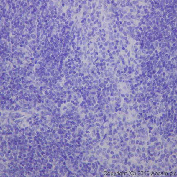Immunohistochemistry (Formalin/PFA-fixed paraffin-embedded sections) - Anti-Prosurfactant Protein C antibody [EPR19839] - Low endotoxin, Azide free (AB222929)