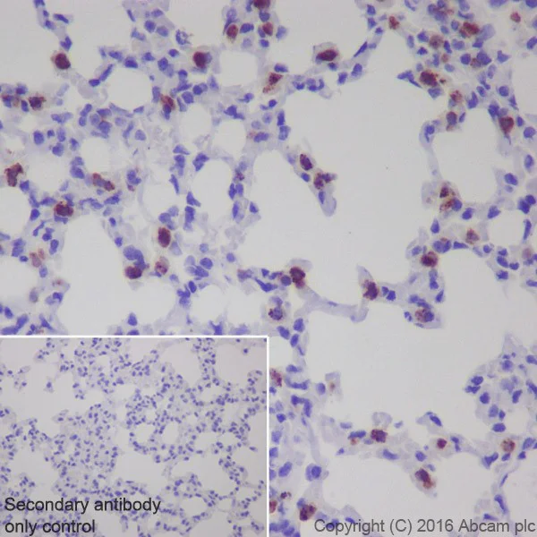 Immunohistochemistry (Formalin/PFA-fixed paraffin-embedded sections) - Anti-Prosurfactant Protein C antibody [EPR19839] - Low endotoxin, Azide free (AB222929)