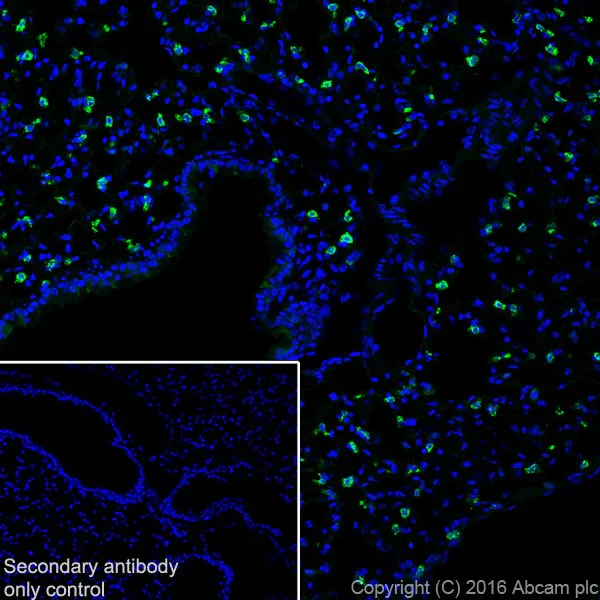 Immunohistochemistry (Frozen sections) - Anti-Prosurfactant Protein C antibody [EPR19839] - Low endotoxin, Azide free (AB222929)