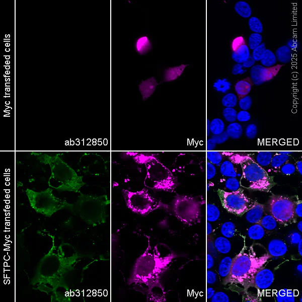 Immunocytochemistry/ Immunofluorescence - Anti-Prosurfactant Protein C antibody [EPR28174-18] (AB312850)