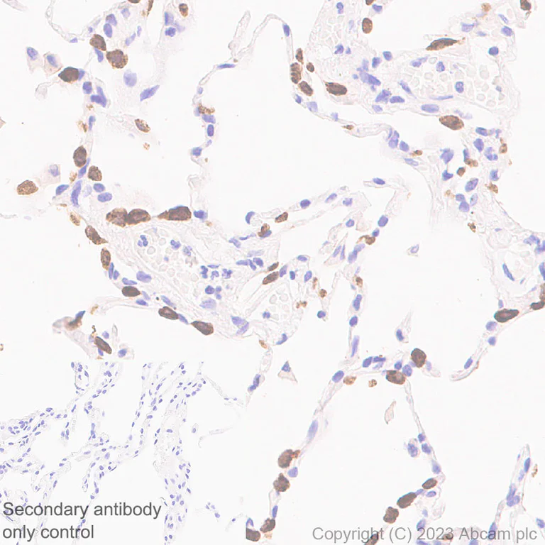 Immunohistochemistry (Formalin/PFA-fixed paraffin-embedded sections) - Anti-Prosurfactant Protein C antibody [EPR28174-18] (AB312850)