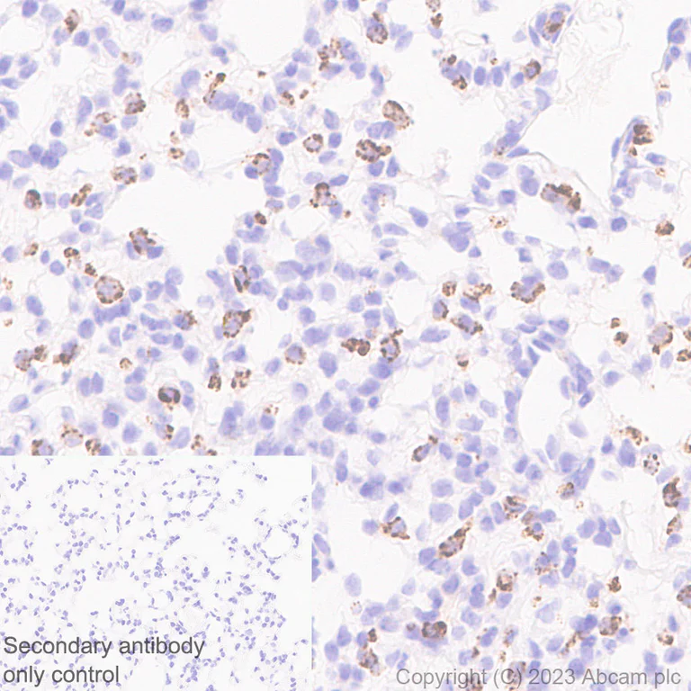 Immunohistochemistry (Formalin/PFA-fixed paraffin-embedded sections) - Anti-Prosurfactant Protein C antibody [EPR28174-18] (AB312850)