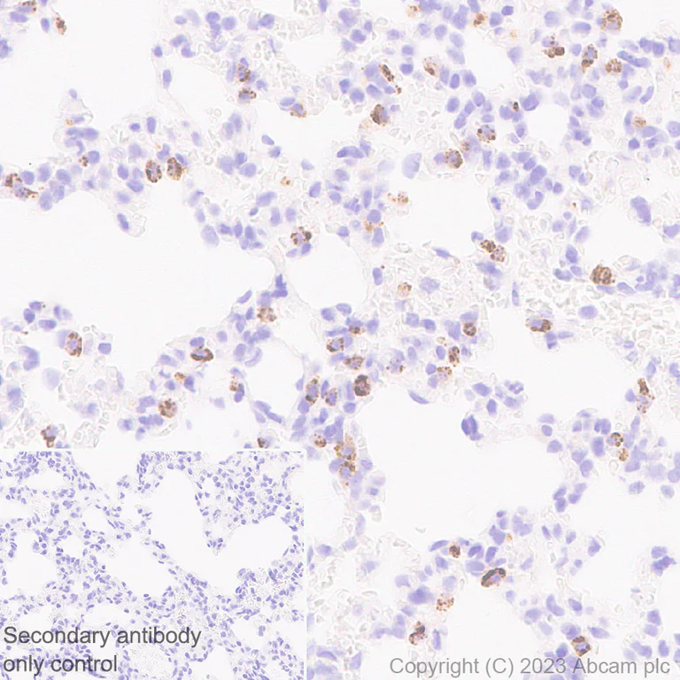 Immunohistochemistry (Formalin/PFA-fixed paraffin-embedded sections) - Anti-Prosurfactant Protein C antibody [EPR28174-18] (AB312850)
