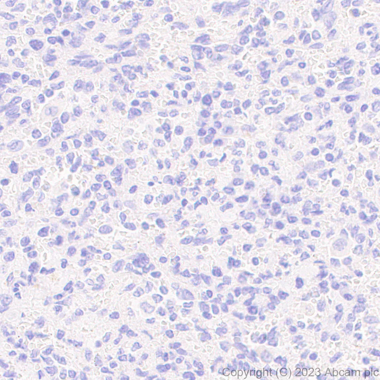 Immunohistochemistry (Formalin/PFA-fixed paraffin-embedded sections) - Anti-Prosurfactant Protein C antibody [EPR28174-18] (AB312850)