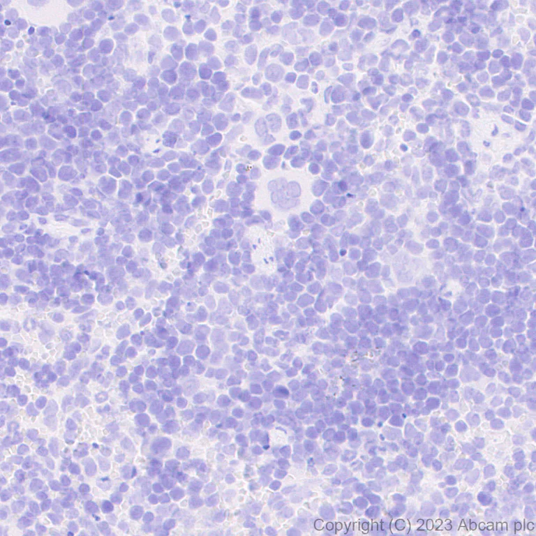 Immunohistochemistry (Formalin/PFA-fixed paraffin-embedded sections) - Anti-Prosurfactant Protein C antibody [EPR28174-18] (AB312850)