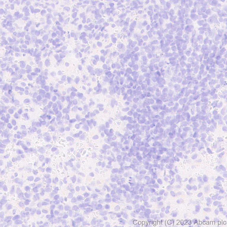 Immunohistochemistry (Formalin/PFA-fixed paraffin-embedded sections) - Anti-Prosurfactant Protein C antibody [EPR28174-18] (AB312850)