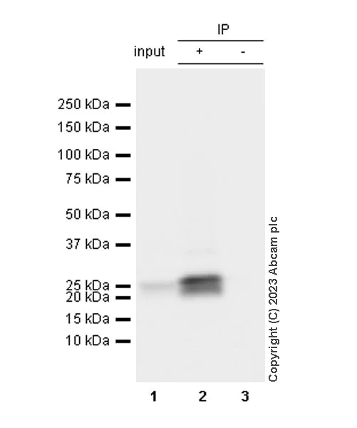 Immunoprecipitation - Anti-Prosurfactant Protein C antibody [EPR28174-18] (AB312850)