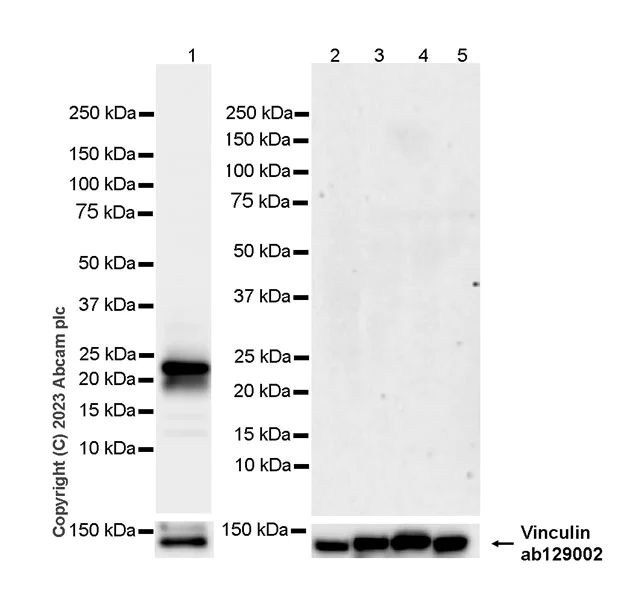 Western blot - Anti-Prosurfactant Protein C antibody [EPR28174-18] (AB312850)