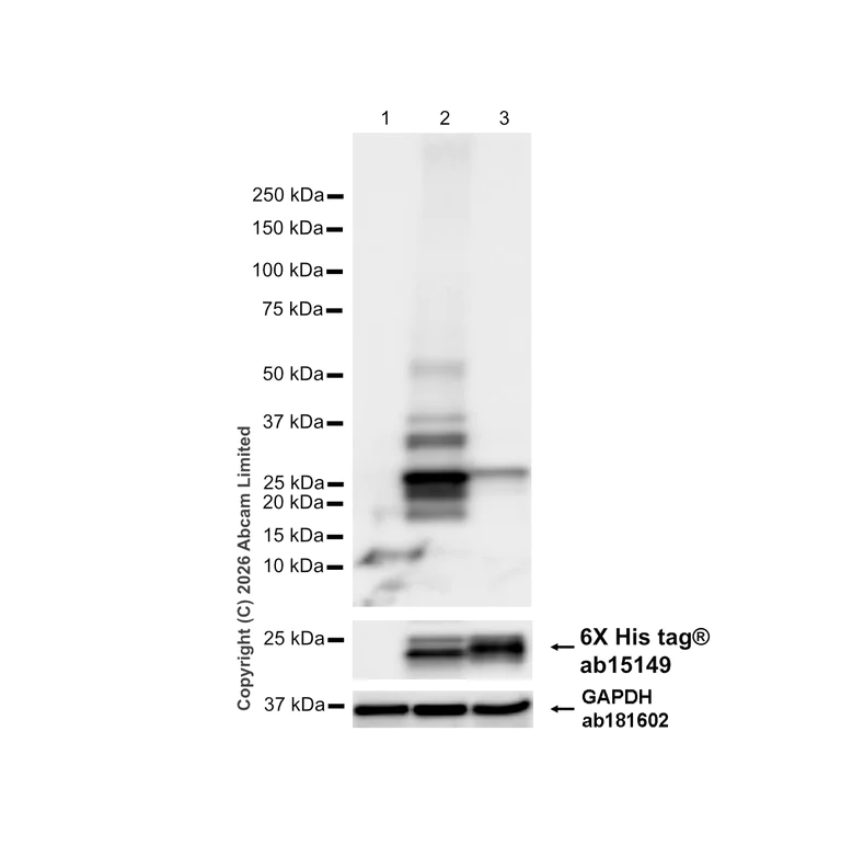 Western blot - Anti-Prosurfactant Protein C antibody [EPR28174-18] (AB312850)