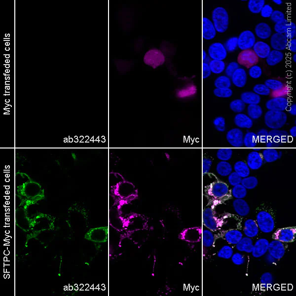 Immunocytochemistry/ Immunofluorescence - Anti-Prosurfactant Protein C antibody [RM1264] (AB322443)