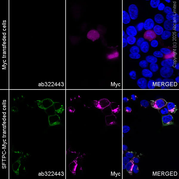 Immunocytochemistry/ Immunofluorescence - Anti-Prosurfactant Protein C antibody [RM1264] (AB322443)