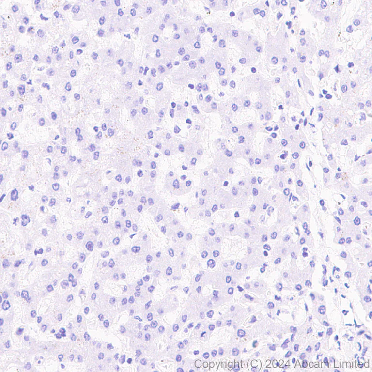 Immunohistochemistry (Formalin/PFA-fixed paraffin-embedded sections) - Anti-Prosurfactant Protein C antibody [RM1264] (AB322443)