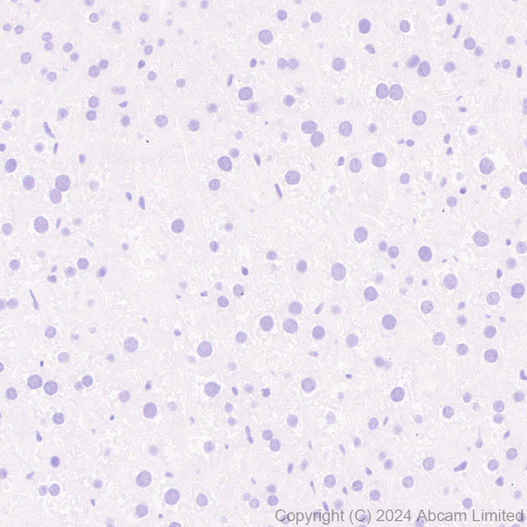 Immunohistochemistry (Formalin/PFA-fixed paraffin-embedded sections) - Anti-Prosurfactant Protein C antibody [RM1264] (AB322443)