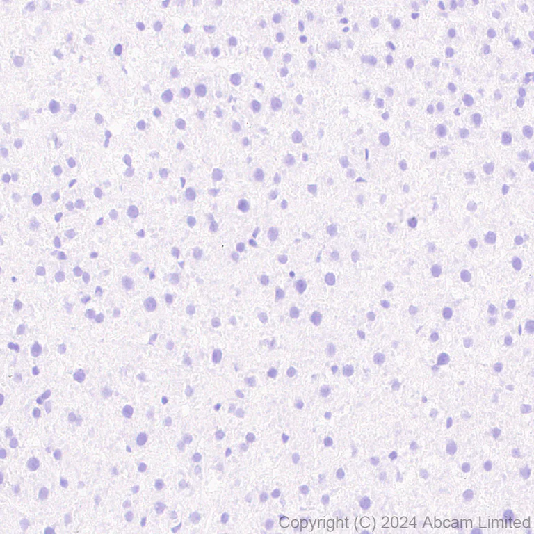 Immunohistochemistry (Formalin/PFA-fixed paraffin-embedded sections) - Anti-Prosurfactant Protein C antibody [RM1264] (AB322443)