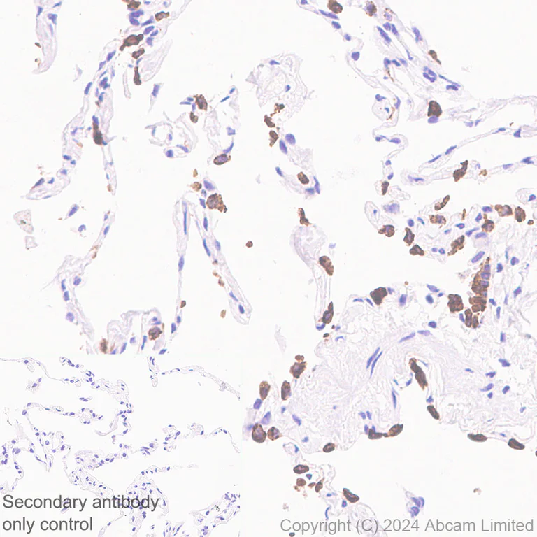 Immunohistochemistry (Formalin/PFA-fixed paraffin-embedded sections) - Anti-Prosurfactant Protein C antibody [RM1264] (AB322443)