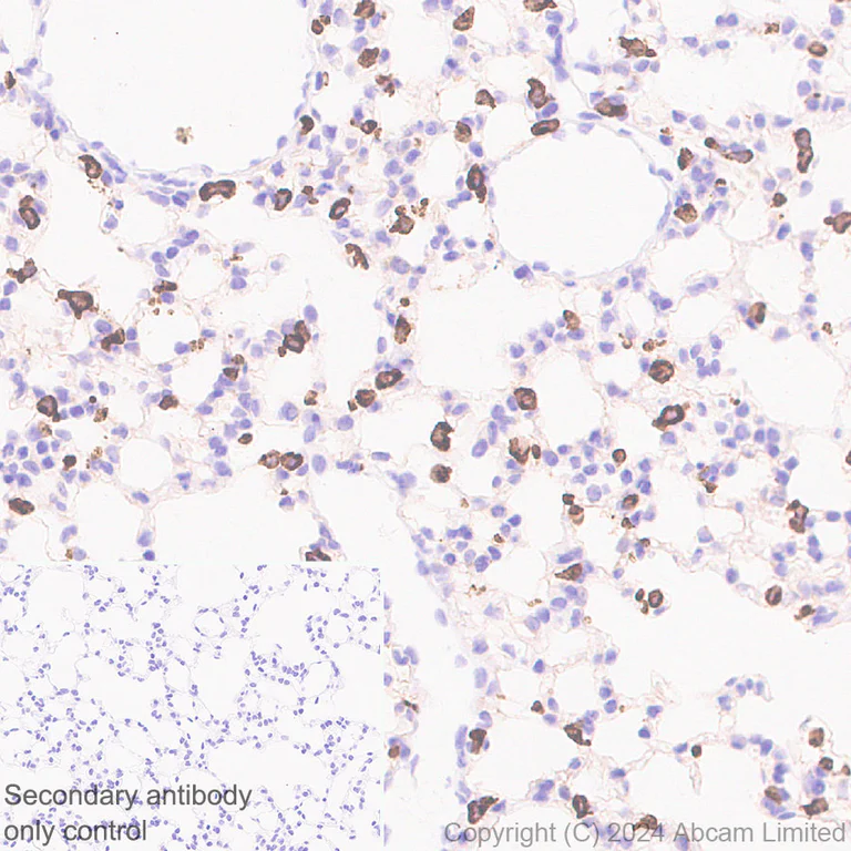Immunohistochemistry (Formalin/PFA-fixed paraffin-embedded sections) - Anti-Prosurfactant Protein C antibody [RM1264] (AB322443)