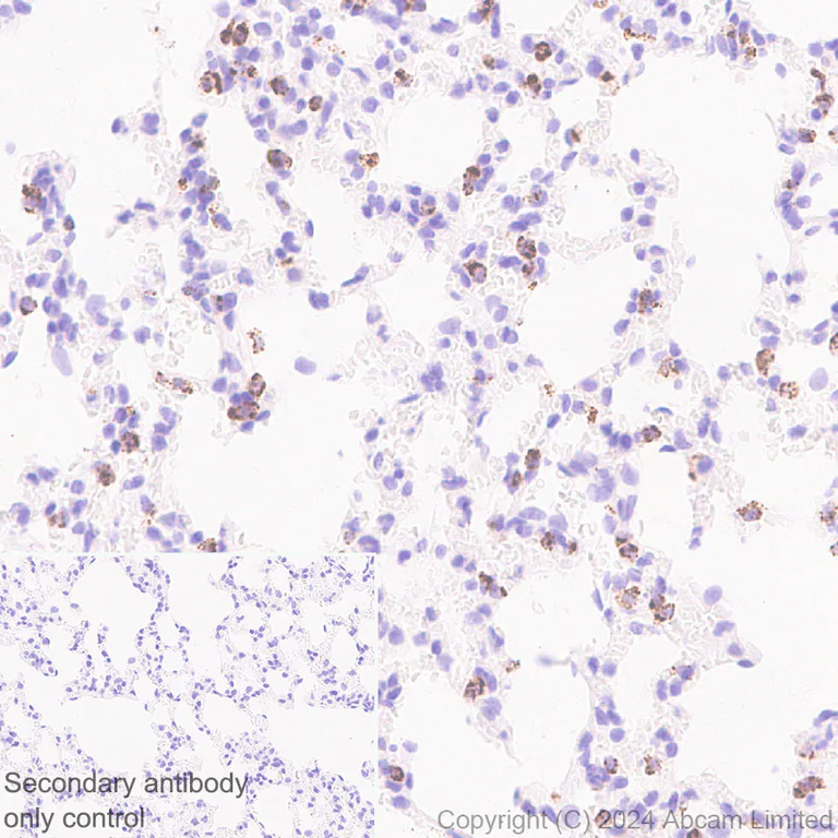 Immunohistochemistry (Formalin/PFA-fixed paraffin-embedded sections) - Anti-Prosurfactant Protein C antibody [RM1264] (AB322443)