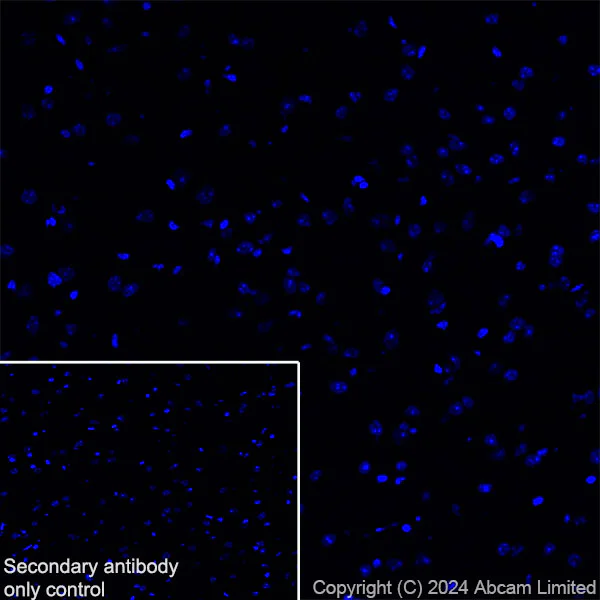 Immunohistochemistry (Frozen sections) - Anti-Prosurfactant Protein C antibody [RM1264] (AB322443)