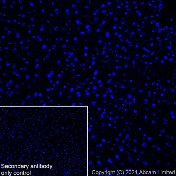 Immunohistochemistry (Frozen sections) - Anti-Prosurfactant Protein C antibody [RM1264] (AB322443)