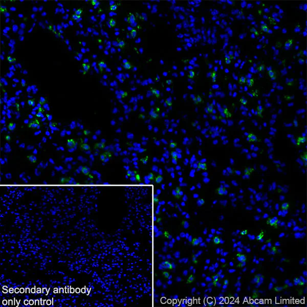 Immunohistochemistry (Frozen sections) - Anti-Prosurfactant Protein C antibody [RM1264] (AB322443)