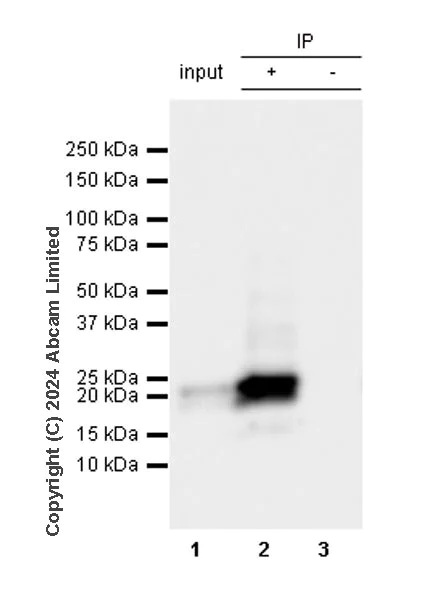 Immunoprecipitation - Anti-Prosurfactant Protein C antibody [RM1264] (AB322443)