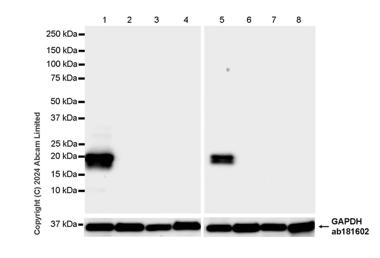 Western blot - Anti-Prosurfactant Protein C antibody [RM1264] (AB322443)